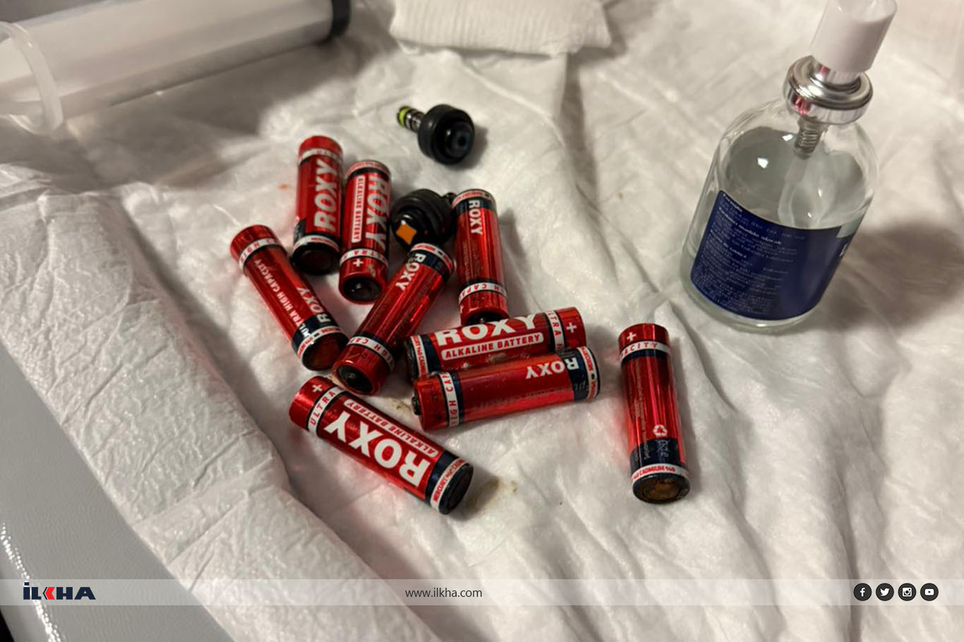 Bir kişi yuttuğu 9 kalem pil endoskopiyle çıkarıldı