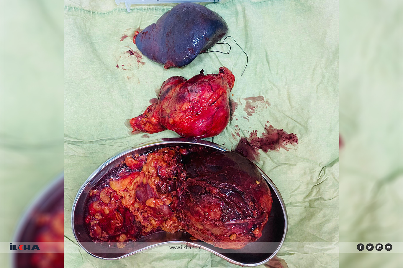 Malatya Eğitim ve Araştırma Hastanesi