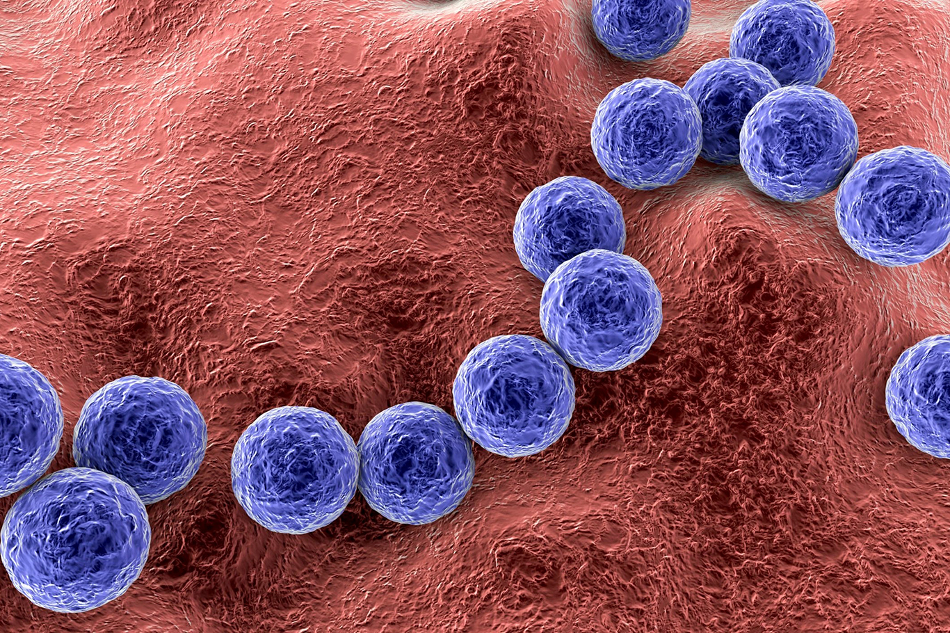 Death toll from Strep A rises to 97 in the United Kingdom Death toll from Strep A rises to 97 in the United Kingdom