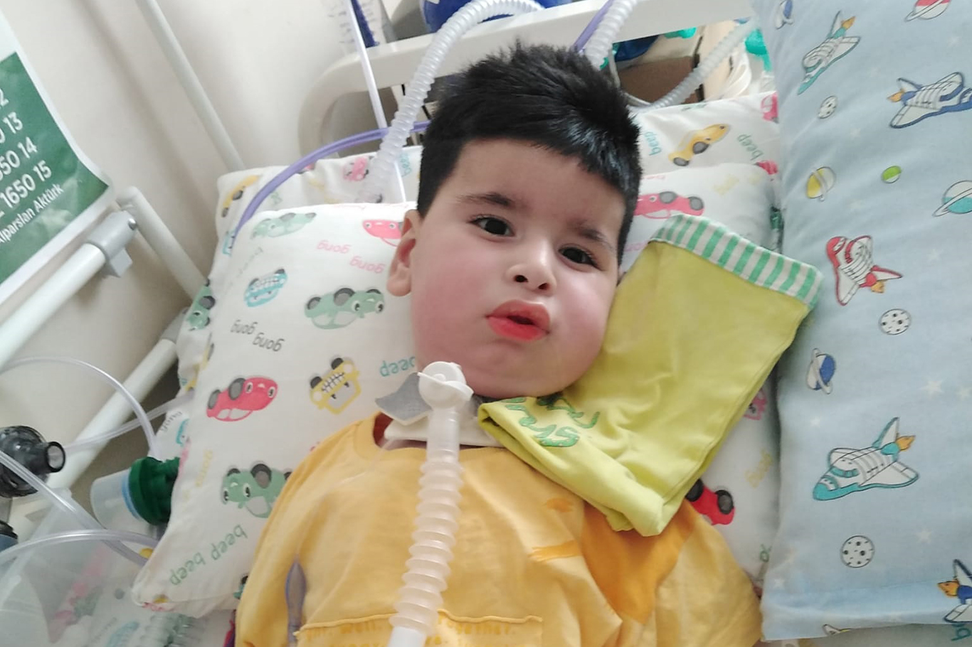 İki ay entübe kalan ve 6 defa kalbi duran SMA hastası Alparslan bebek hayırseverlerden destek bekliyor! İki ay entübe kalan ve 6 defa kalbi duran SMA hastası Alparslan bebek hayırseverlerden destek bekliyor!
