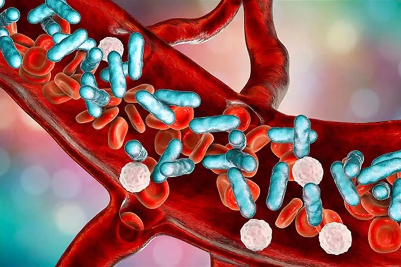 Prof. Dr. Demirel: Sepsis, dünya üzerinde her beş ölümden birinin sebebidir Prof. Dr. Demirel: Sepsis, dünya üzerinde her beş ölümden birinin sebebidir