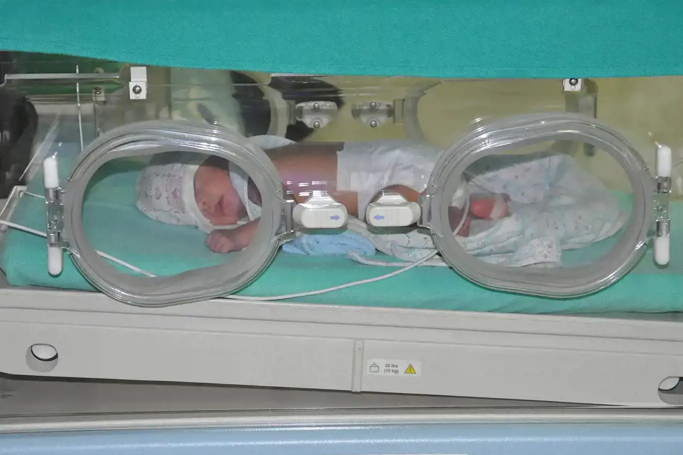 UN agencies report 13.4 million preterm births in 2020, leading to almost one million infant deaths UN agencies report 13.4 million preterm births in 2020, leading to almost one million infant deaths