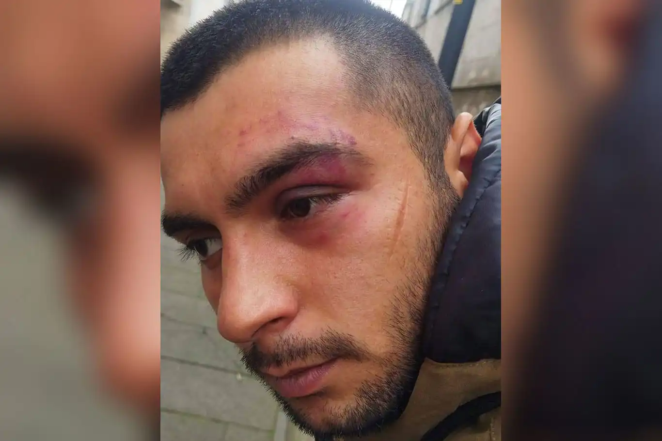 Arbede sonrası karakola götürülen gencin darp edildiği iddiası Arbede sonrası karakola götürülen gencin darp edildiği iddiası
