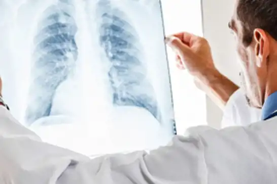 Aktif yaşam sağlıklı bireyler kadar kronik akciğer hastaları için de önemli