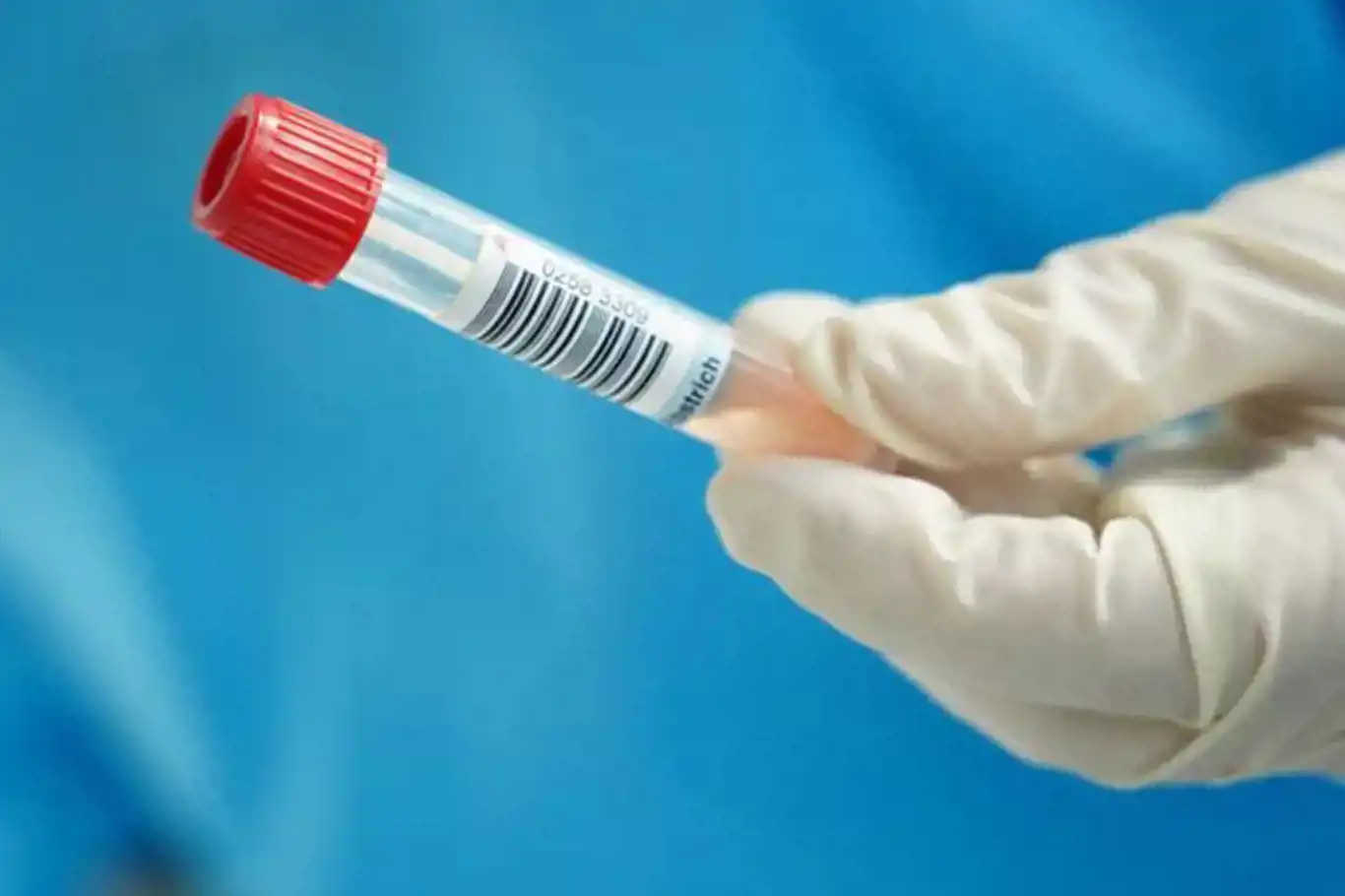 Egypt reports first cases of EG.5.2 "Eris" variant of COVID-19 as global prevalence rises