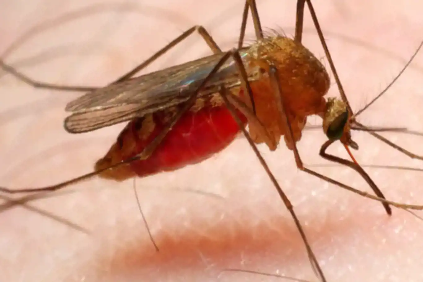 Malaria outbreak spreads rapidly in Ethiopia's Oromia region