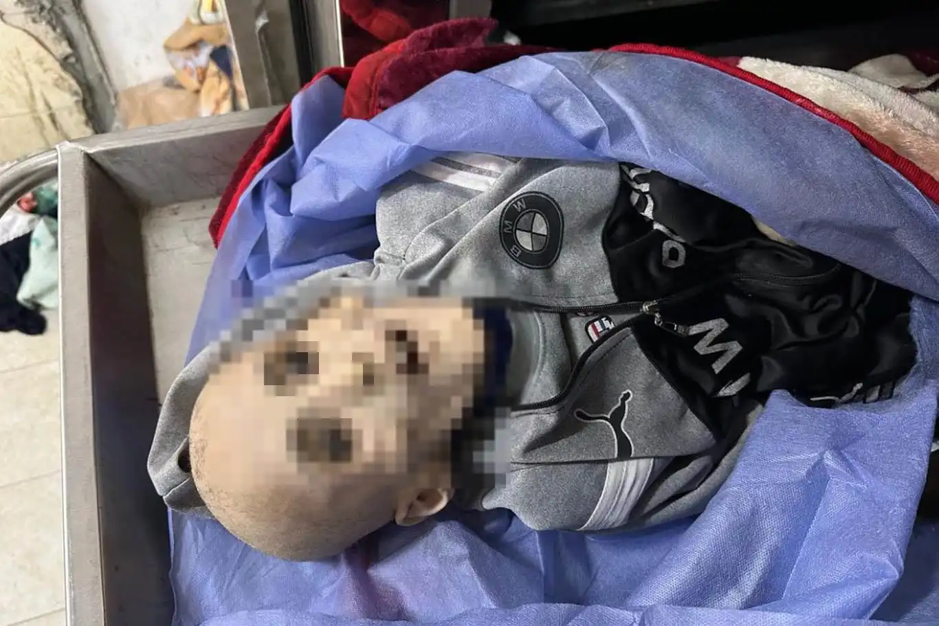 Gaza genocide: 18 Palestinians died of malnutrition and dehydration Gaza genocide: 18 Palestinians died of malnutrition and dehydration