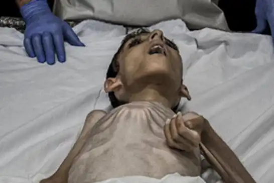 Gazze Şeridi'nde açlıktan dolayı bir çocuk daha vefat etti