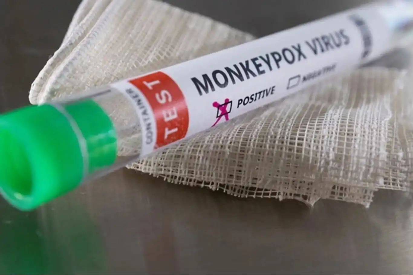 South Africa reports second monkeypox death amidst ongoing outbreak ...