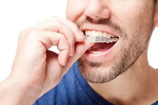 Ortodonti hakkında doğru bilinen yanlışlar
