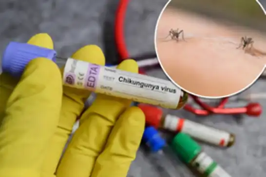 ABD'de chikungunya vakası görüldü