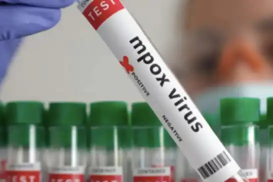 Namibia confirms first MPOX case in coastal  city of  Swakopmund