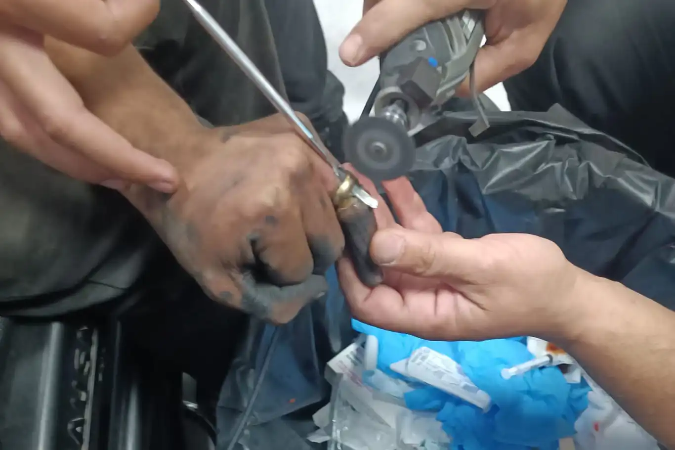 Batman'da parmakta sıkışan yüzük operasyonla çıkarıldı Batman'da parmakta sıkışan yüzük operasyonla çıkarıldı