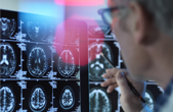 أسئلة بسيطة لرصد العلامات المبكرة للزهايمر