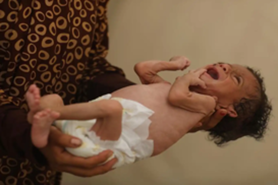 Gaza famine deepens: Two more children die of starvation