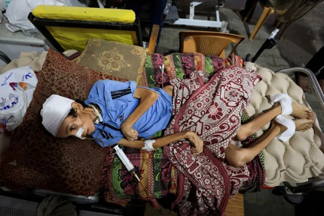 Gazze’de açlıktan ölenlerin sayısı 457'ye yükseldi