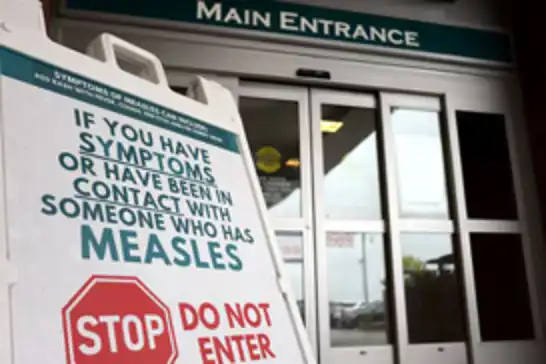 Kanada'da kızamık vakalarında artış 