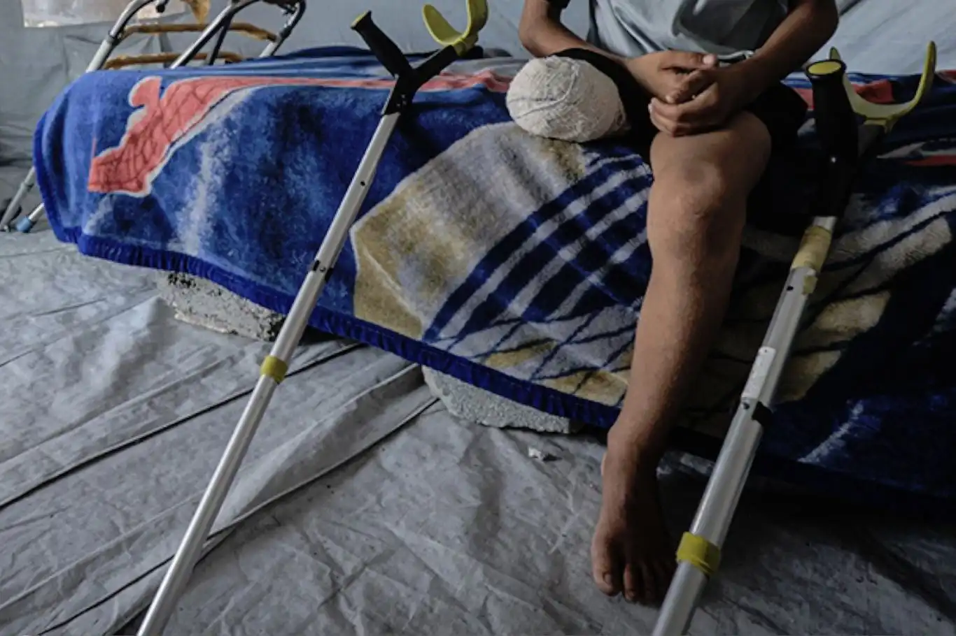 Gazze'de 6 bin ampute vakası acil ve uzun süreli rehabilitasyona ihtiyaç duyuyor