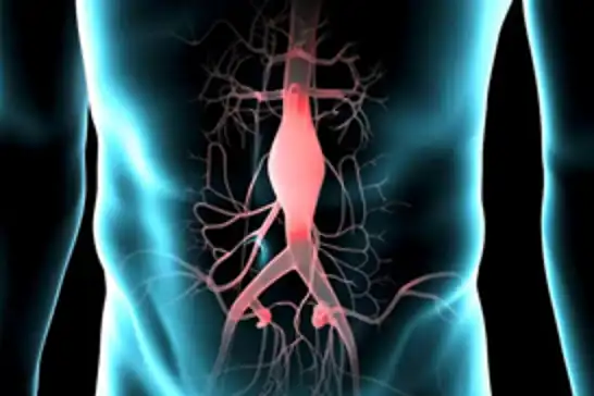 Sessiz ama tehlikeli bir hastalık: Aort anevrizması