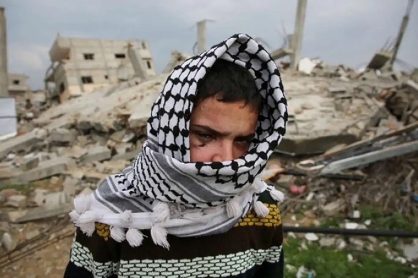 Gazze'de binlerce kişi görme kaybı riski altında