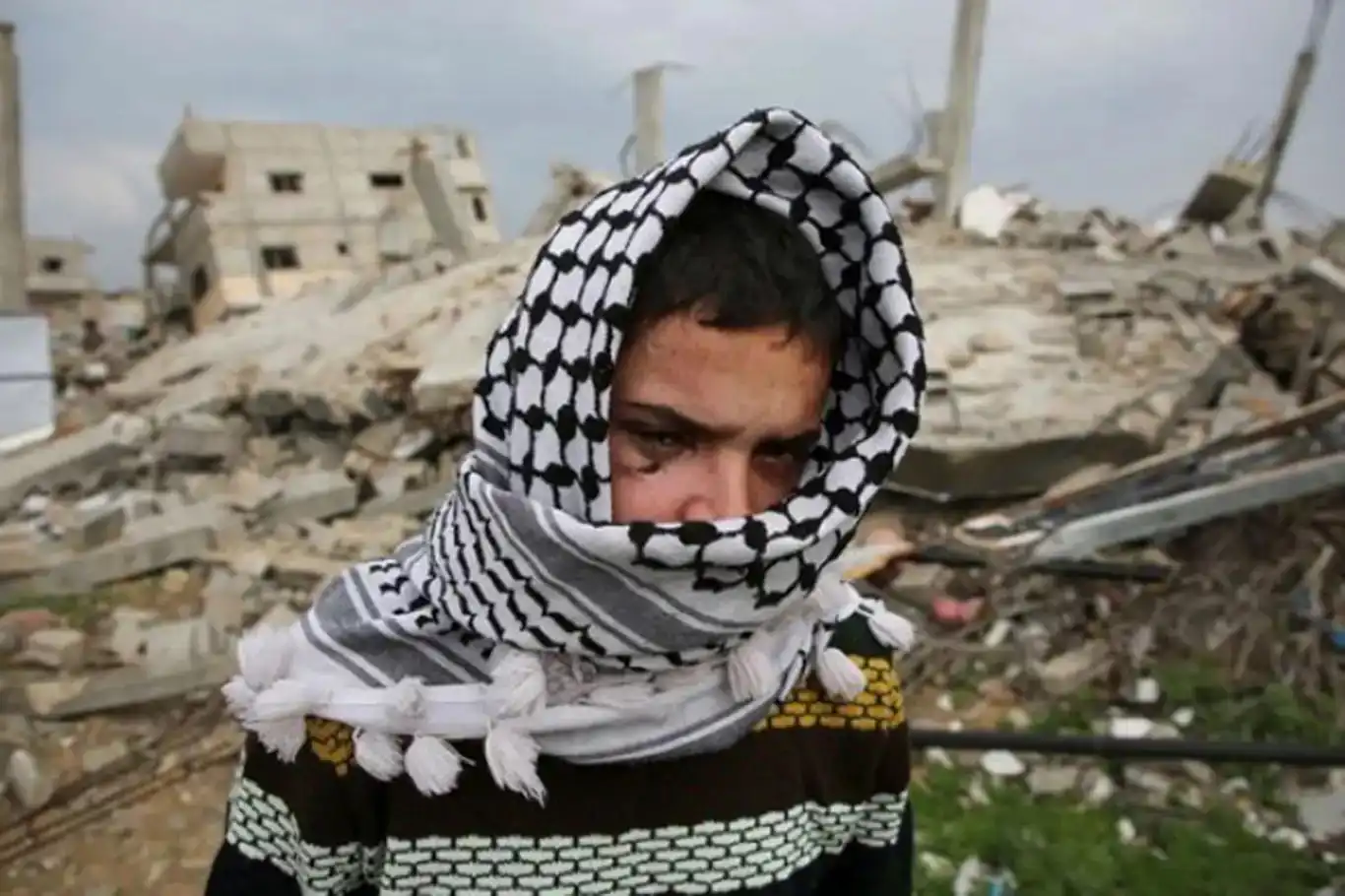 غزة: آلاف الفلسطينيين مهددون بفقدان البصر جراء استهداف العيون ومنع العلاج