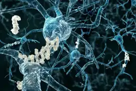 Alzheimer’a erken müdahale umudu: Deneysel ilaç beyindeki hasarı azalttı