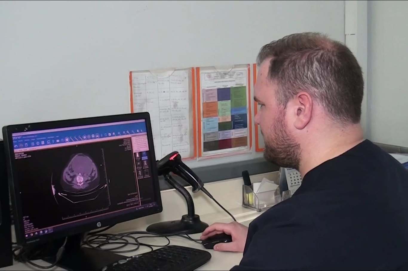 Balıklıgöl Devlet Hastanesi’nde 25 santimetrelik dev kist başarıyla alındı