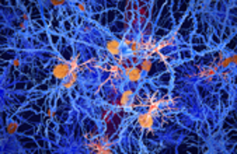 علاج متطور يعيد الذاكرة ويقي من النوبات