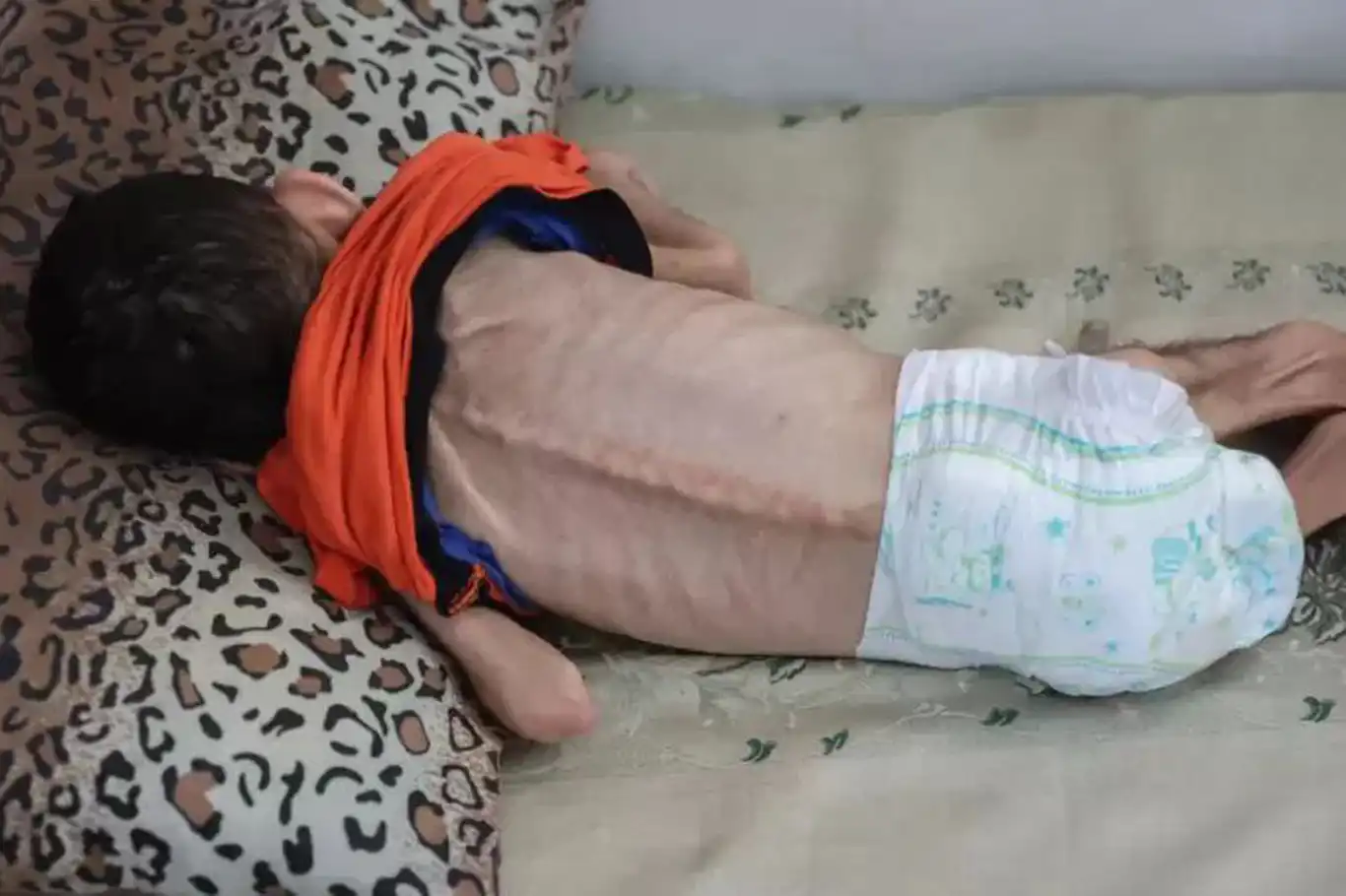 UN sounds the alarm: Israeli blockade starving Gaza, humanitarian collapse imminent