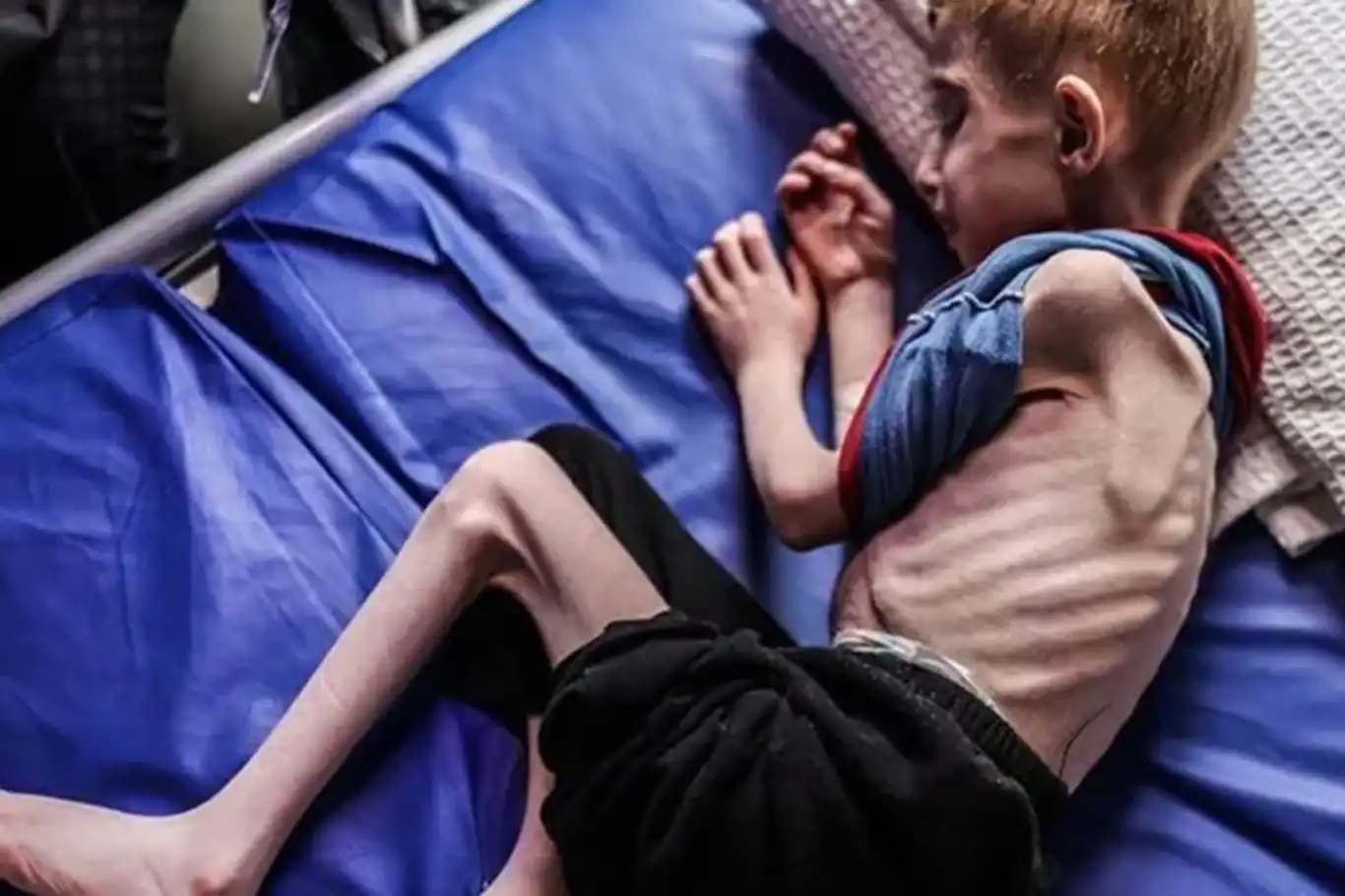 WHO: Gaza’s health system collapsing as Israel blocks lifesaving aid WHO: Gaza’s health system collapsing as Israel blocks lifesaving aid