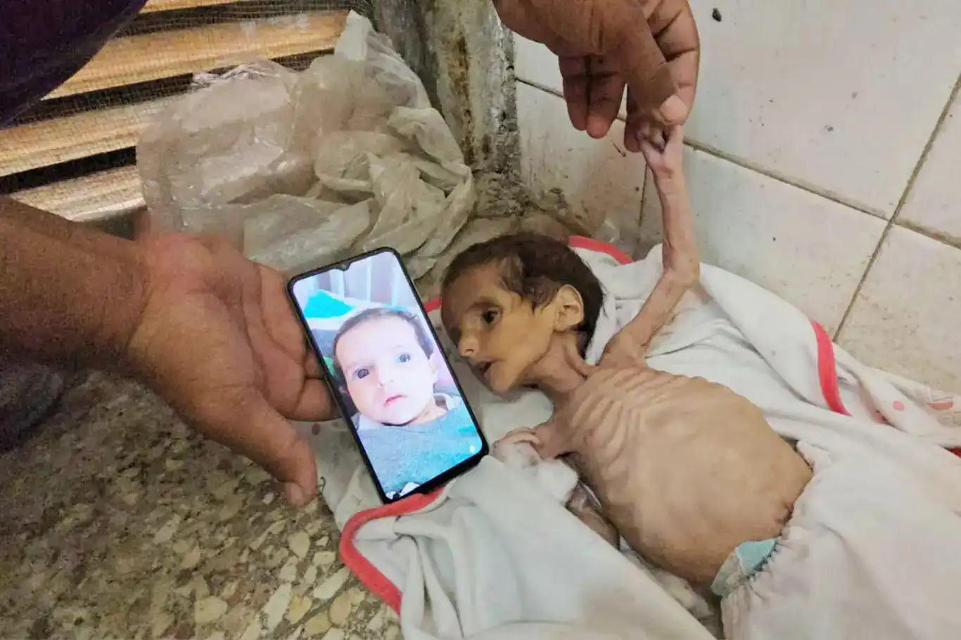 أكثر من 100 طفل يدخلون المستشفيات يوميًا في غزة بسبب سوء التغذية أكثر من 100 طفل يدخلون المستشفيات يوميًا في غزة بسبب سوء التغذية