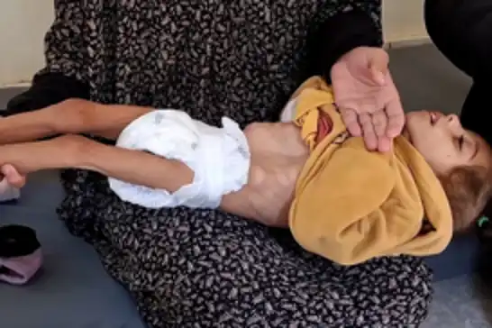 Gazze'de açlıktan ölen çocukların sayısı 66'ya yükseldi