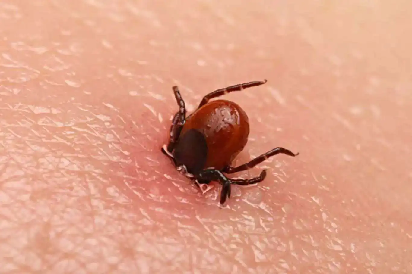 Sixth CCHF fatality reported in Sivas as tick-borne threat grows Sixth CCHF fatality reported in Sivas as tick-borne threat grows