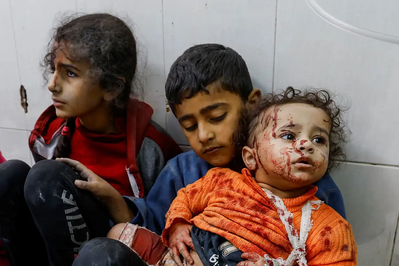 Gaza faces child meningitis crisis as medical stocks disappear Gaza faces child meningitis crisis as medical stocks disappear