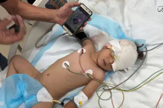 بسبب الجوع ونفاد الإمدادات..مليون طفل في غزة يواجهون خطر الموت
