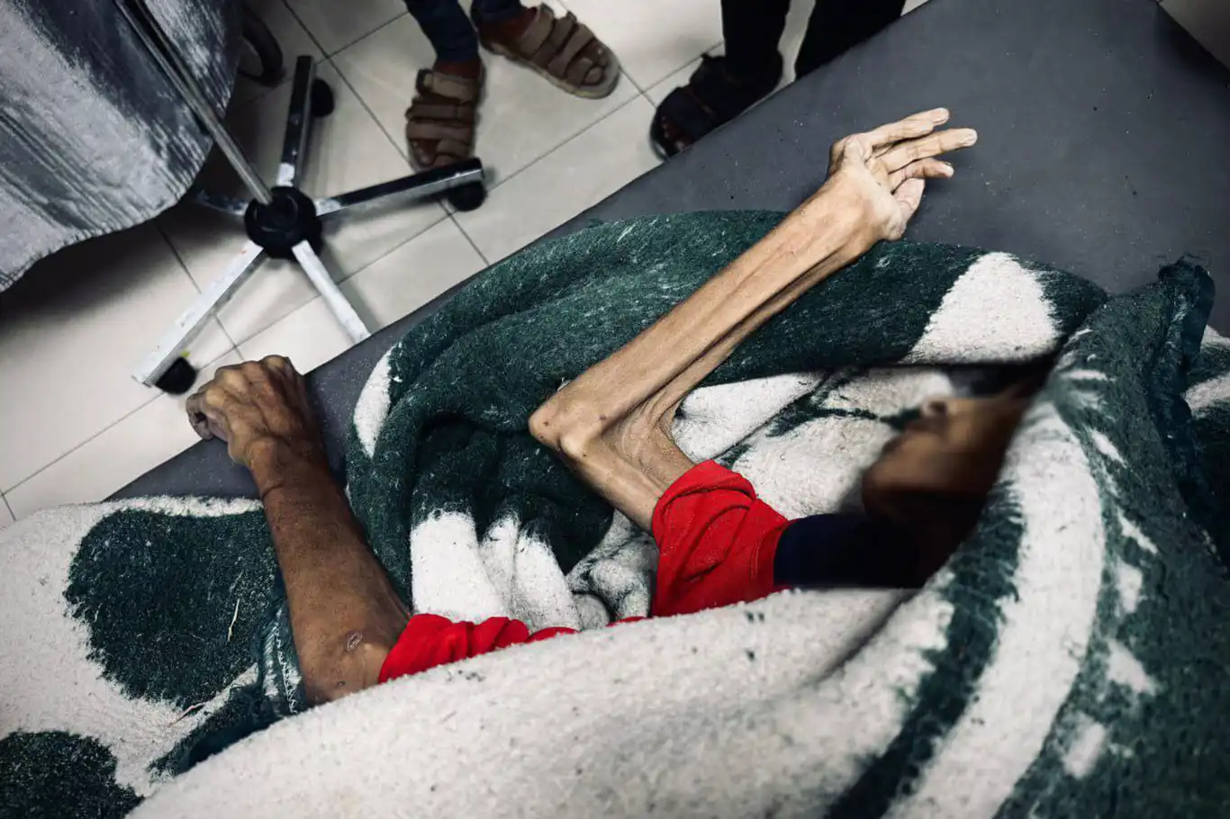 UN sounds alarm over worsening hunger crisis in Gaza UN sounds alarm over worsening hunger crisis in Gaza