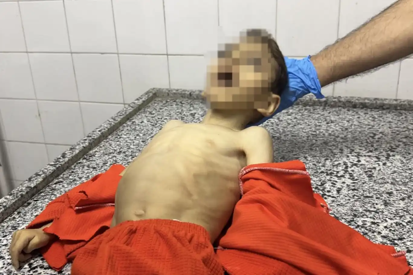 Açlık Gazze'de çocukları vurmaya devam ediyor: 3 günde 21 çocuk şehit oldu Açlık Gazze'de çocukları vurmaya devam ediyor: 3 günde 21 çocuk şehit oldu