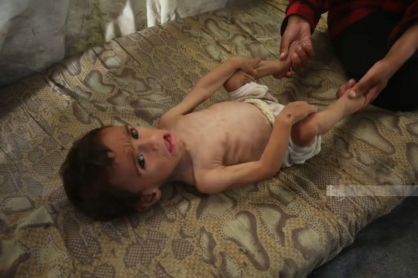 وزارة الصحة بغزة: 9 حالات وفاة جديدة بسبب المجاعة