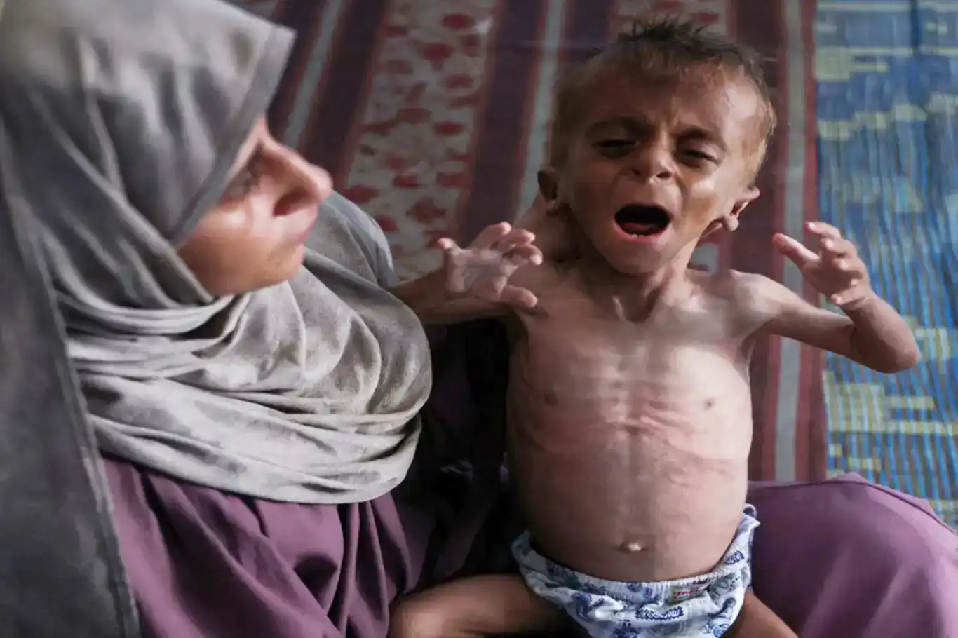 الجوع يفتك بأطفال غزة: بدأوا بأكل الأعشاب الجوع يفتك بأطفال غزة: بدأوا بأكل الأعشاب
