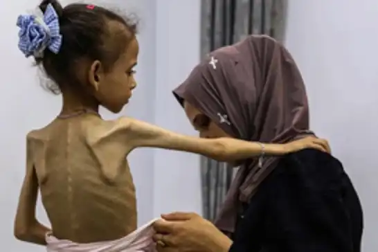 الأمم المتحدة: "مؤشرات المجاعة في غزة تجاوزت الحدّ الكارثي"