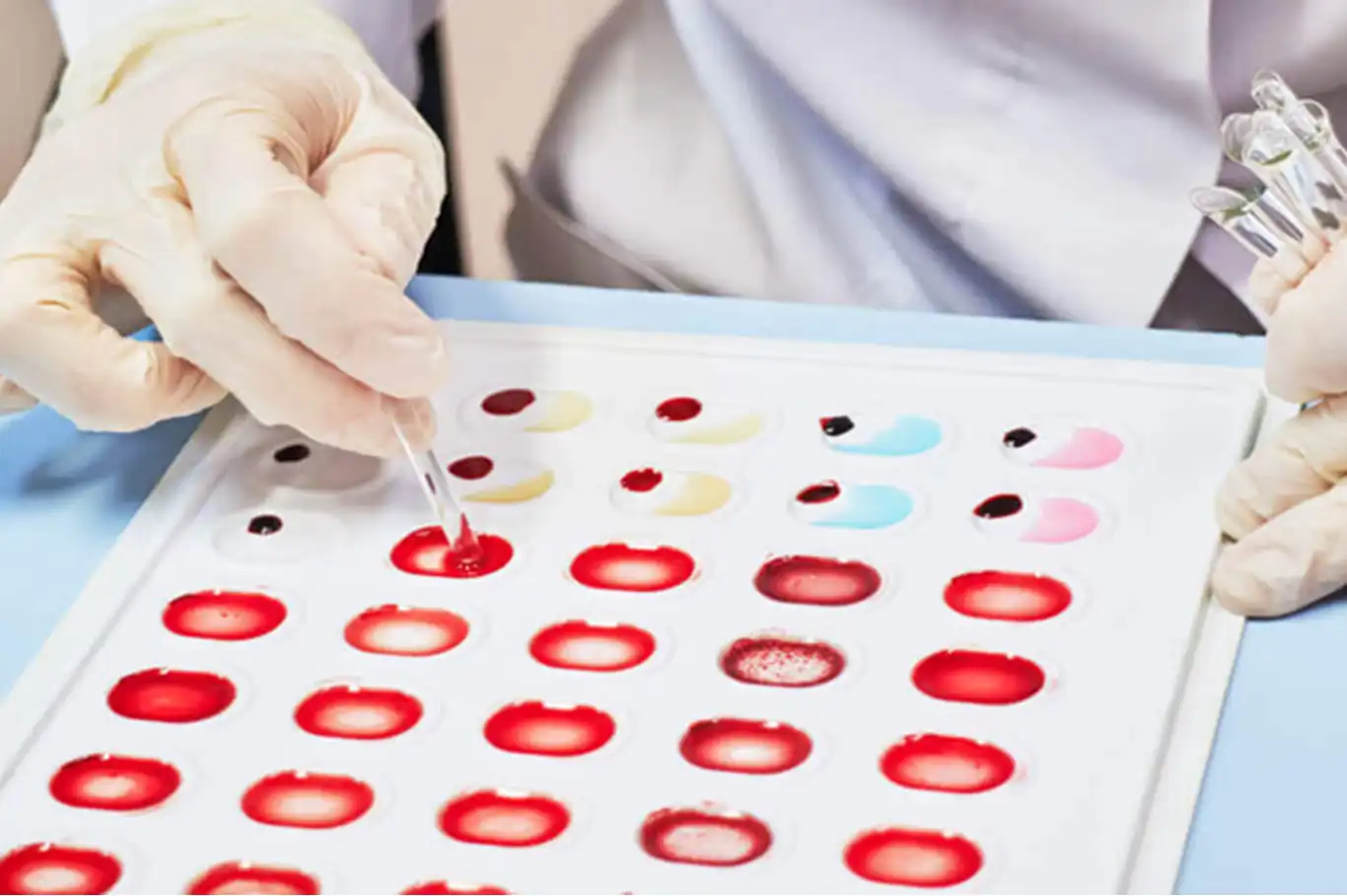New blood group discovered in South Indian woman New blood group discovered in South Indian woman