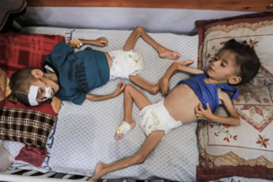 UN warns of “catastrophic milestone” as child deaths from starvation in Gaza exceed 100