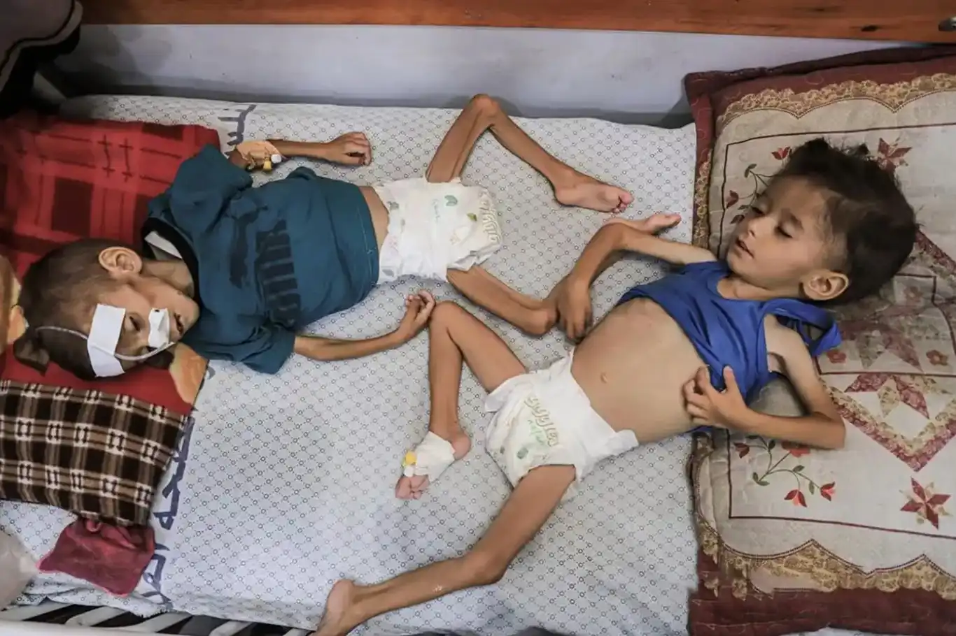 وسط انهيار صحي شامل..أكثر من 18 ألف طفل في غزة يواجهون خطر المجاعة وسط انهيار صحي شامل..أكثر من 18 ألف طفل في غزة يواجهون خطر المجاعة