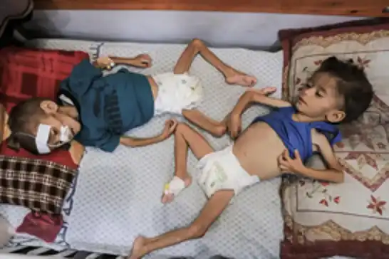 وسط انهيار صحي شامل..أكثر من 18 ألف طفل في غزة يواجهون خطر المجاعة