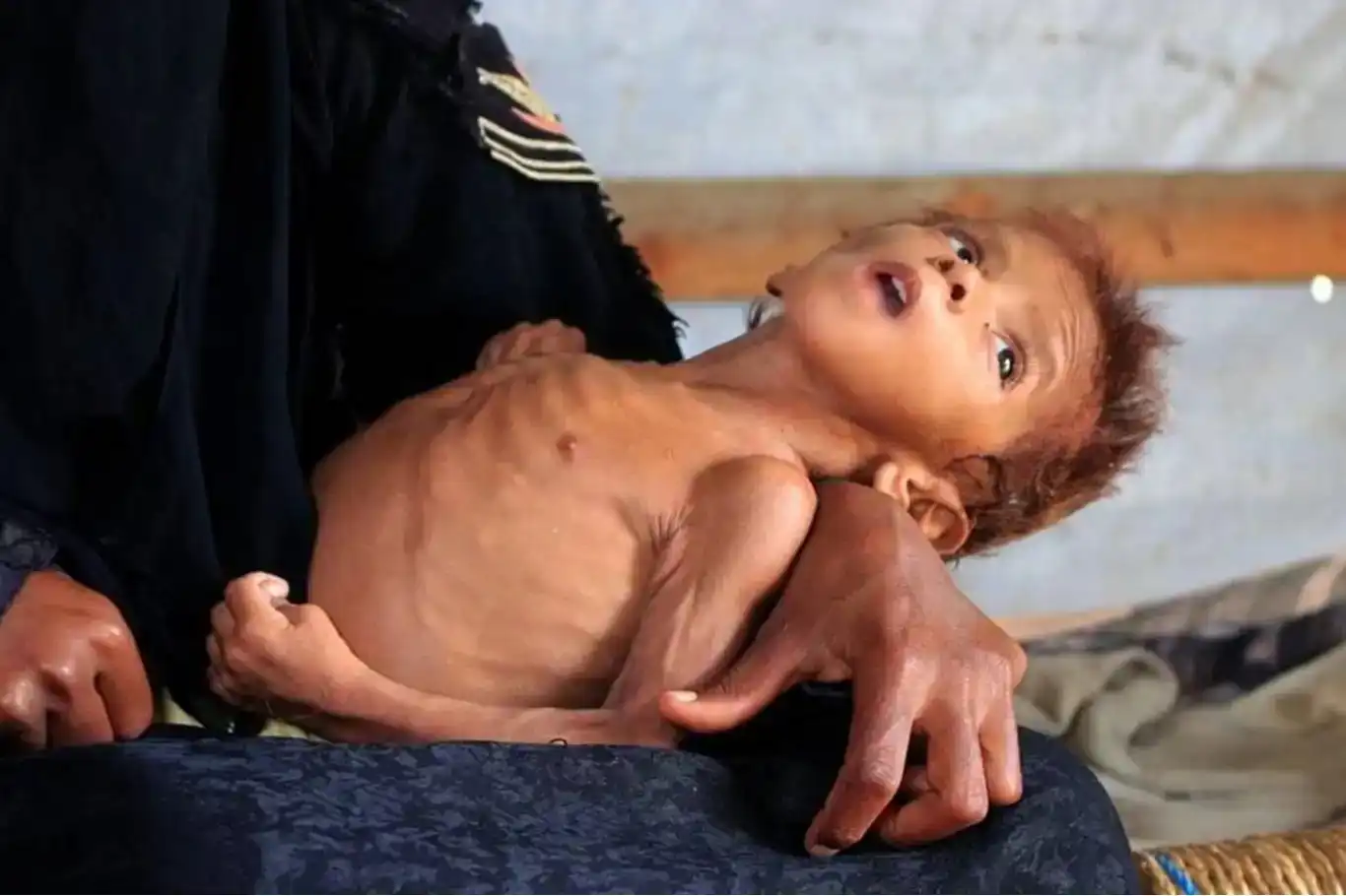 Gaza government: More than 40,000 infants face death due to malnutrition Gaza government: More than 40,000 infants face death due to malnutrition