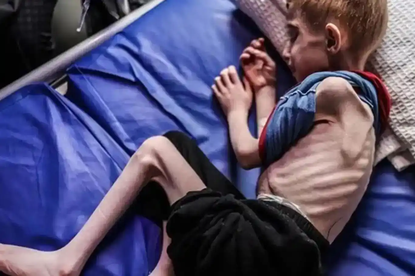 لە غەززە ٥ کەسی دیکە بەهۆی برسێتی گیانیان لەدەستدا لە غەززە ٥ کەسی دیکە بەهۆی برسێتی گیانیان لەدەستدا