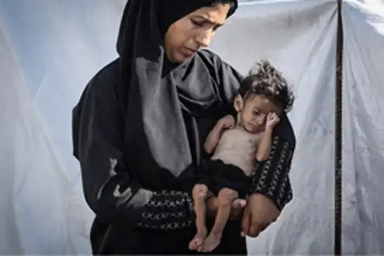 لازارینی: سوءتغذیه در میان کودکان غزه در عرض شش ماه سه برابر شده است