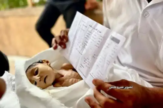 لە غەززە منداڵێکی تەمەن ٥ مانگ بە هۆی بەدخۆراکییەوە گیانی لەدەستدا