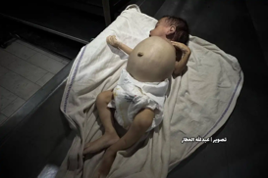 Israel’s siege starves Gaza: Eight more lives lost to hunger