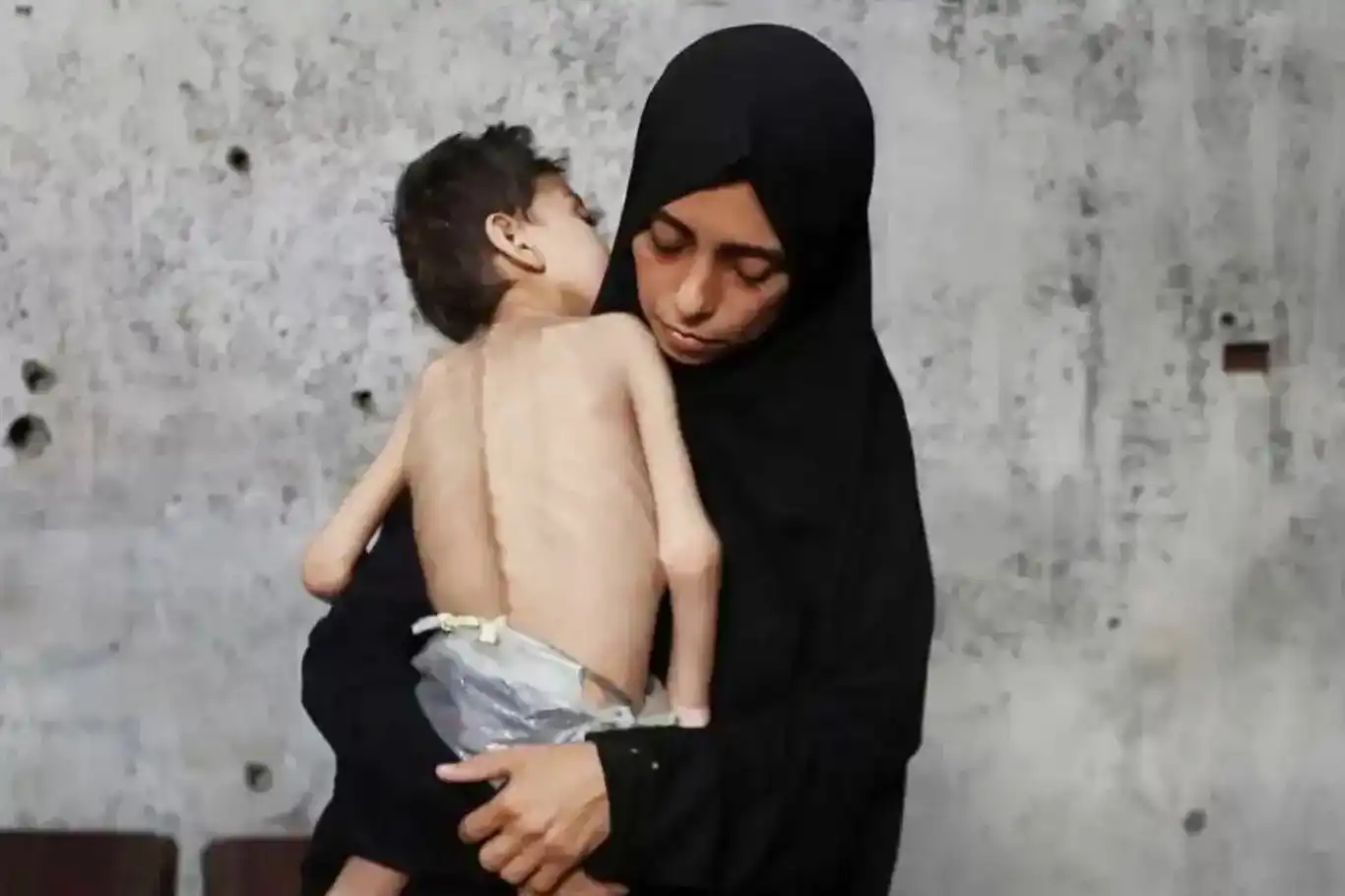 غزة تموت جوعاً..استشهاد 3 فلسطينيين آخرين جراء الجوع وسوء التغذية غزة تموت جوعاً..استشهاد 3 فلسطينيين آخرين جراء الجوع وسوء التغذية